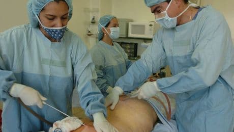 Procesados 10 médicos por el homicidio imprudente de una mujer que murió tras una lipoescultura