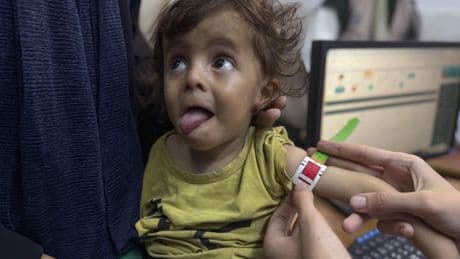 Israel provoca en Gaza la primera hambruna declarada oficialmente en Oriente Medio