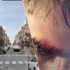 Brusselse influencer raakt gewond na steekincident in Ukkel