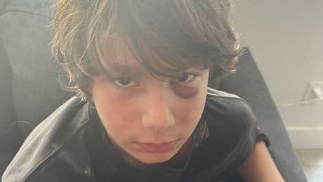 ‘Shocked and scared’: Kelowna boys assaulted at bus stop