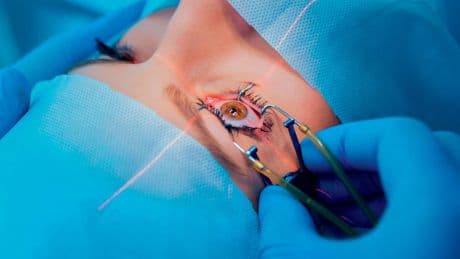 Miniaturisée et hyperprécise: les prouesses de la chirurgie ophtalmique