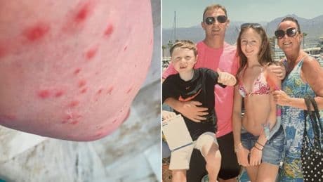 Mum in coma after mosquito bites cause her to fall down stairs on holiday