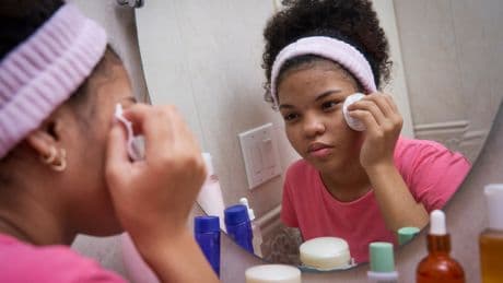 7 Conditions A Dermatologist Says Even Experts Miss On Skin Of Colour