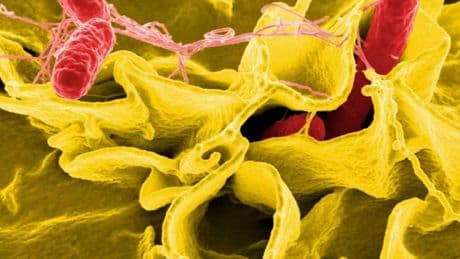 Un brote de gastroenteritis en una boda en Cantabria deja al menos 46 afectados