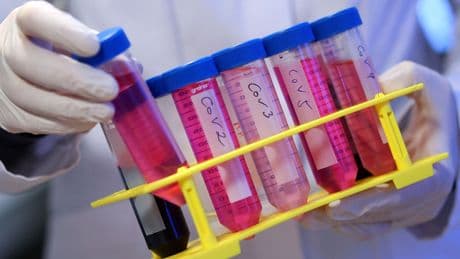 Long Covid causes effects similar to Parkinson’s or stroke, scientists find