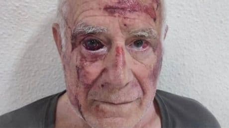 Detenidos dos marroquíes en situación irregular por encubrir la paliza al anciano en Torre Pacheco