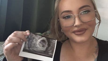 Woman becomes pregnant after taking Mounjaro weight loss jabs in little-known side effect