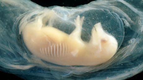 Un equipo científico logra hacer crecer corazones de células humanas en embriones de cerdo