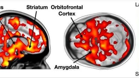Music Resonates And Rewards The Brain