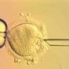 Eight babies have been born in Britain using a new three-person IVF technique designed to prevent hereditary diseases
