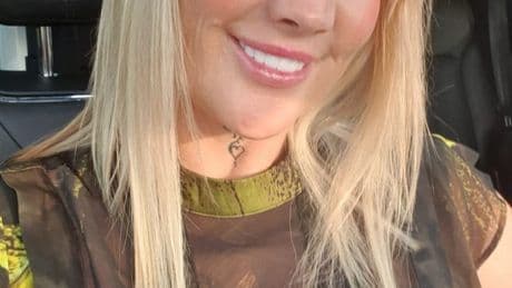Mum shares horrifying photos of Turkey teeth op gone wrong – and warns ‘the perfect smile doesn’t exist’