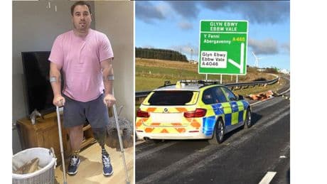 Man who had leg amputated after hit-and-run describes 'agony' of 'phantom pain'