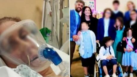 Francesca Bonivardo, un batterio le divora il corpo: necrosi sul 70% della pelle. Avviata raccolta fondi: è mamma di otto figli