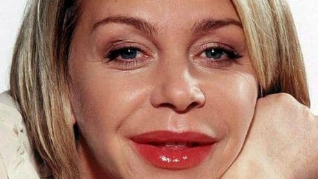 Leslie Ash unveils facelift results after 'losing herself completely' over botched lips