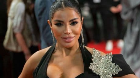 « Plusieurs fractures au visage, de nombreuses coupures sur tout le corps », des suspicions de viol… L’influenceuse marseillaise Soraya Riffy agressée lors d’un cambriolage