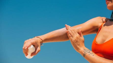 Scottature da sole, quali sono i rimedi naturali per dare sollievo alla pelle