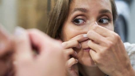 Doctor warns popping spot on area of your face 'could kill you'