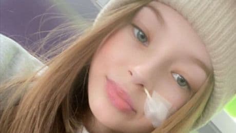 Teen model, 13, diagnosed with rare cancer after 'cold' symptoms on holiday