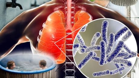 Urgent warning over fatal lung disease spread through contaminated water in taps, showers, hosepipes and hot tubs