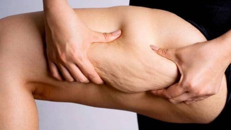 La fruta que te ayudará a combatir la celulitis y que destaca por sus propiedades antiinflamatorias