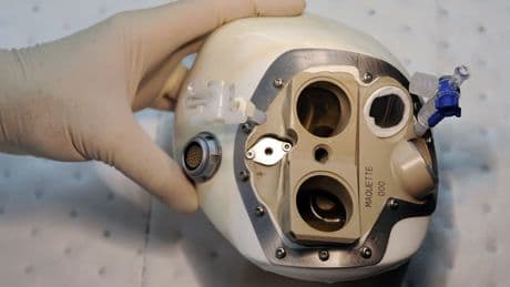 En redressement judiciaire, le fabricant de cœurs artificiels Carmat va examiner une offre de reprise