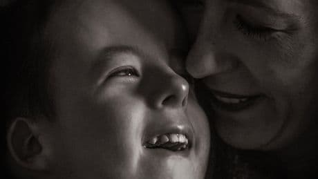 Trisomy 18 Was Once Seen as Too Lethal to Treat. Some Kids Are Now Surviving.
