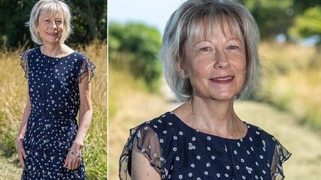 Cruel rosacea robbed Janet of her looks. Antibiotics and creams failed her - then doctors tried a game-changing new treatment and she has clear skin for the first time in decades