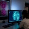 Vijf minuten is genoeg om borstkanker op te sporen; MRI-scan kan bij screening veel korter