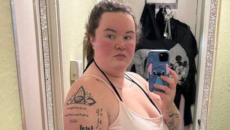 ‘Mounjaro is making my hair fall out – but it’s worth it to lose weight’