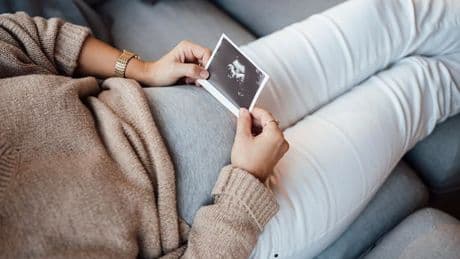 'People say my baby scan looks like Claudia Winkleman and I can't unsee it'