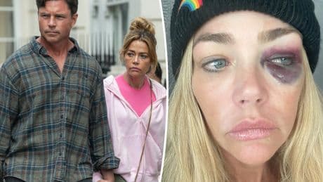Denise Richards claims estranged husband Aaron Phypers threatened to kill her — as she reveals gruesome photos of alleged abuse