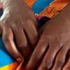 Krankheiten: Internationale Notlage wegen Mpox aufgehoben