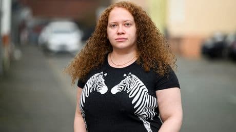 Felicia (29) ist immer in Gefahr - „Die Sepsis hat mich zweimal fast umgebracht“