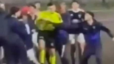 Diego picchiato selvaggiamente nel torneo Under 17: le parole non bastano&nbsp;pi&ugrave;