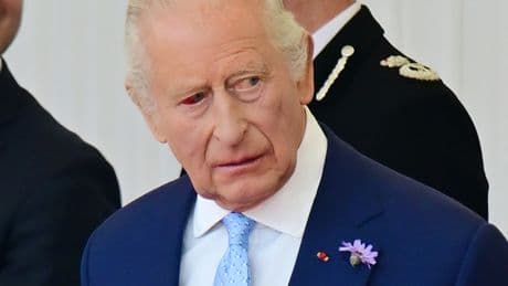 Palace explains King Charles’ worrying bloodshot eye during Macron’s state visit