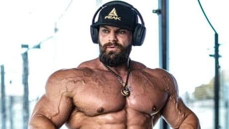 Star-Bodybuilder leidet an seltener Krankheit - „Ich bin fast gestorben“