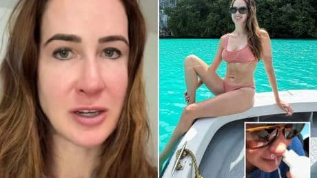 I got a horrifying 7-year infection after my boyfriend farted in my face – docs were stunned when they looked up my nose
