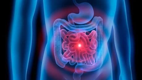 El test sencillo que deben hacerse todos los mayores de 50 años para prevenir el cáncer de colon