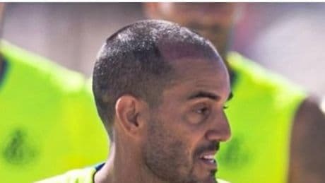 Juanmi, ausente en la pretemporada del Getafe por un tratamiento capilar