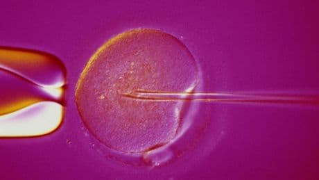 Scandale en Belgique autour d'un donneur de sperme danois, porteur d'une mutation génétique