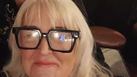 Scots mum regrets 'silly' choice not to wear sunhat after shock cancer diagnosis