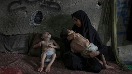 PHOTO ESSAY: Starvation attacks the bodies of these children in Gaza