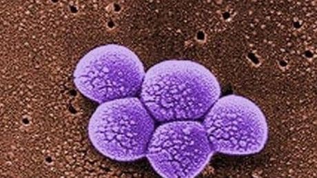 ‘Avoid sharing towels and razors’ amid rise in people contracting MRSA, Britons told