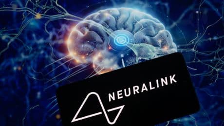 Elon Musk’s brain implant startup Neuralink surges in value to $9B: report