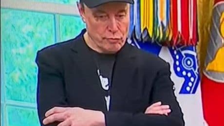 Elon Musk e il mistero dell'occhio nero