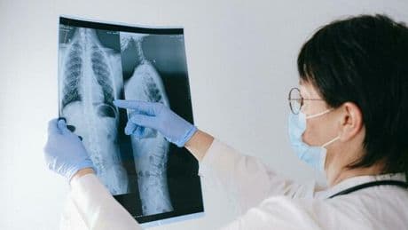 Asma e Bpco: gli pneumologi lanciano una campagna social per le diagnosi precoci