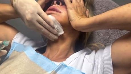 Saint-Tropez: "Was hat er mir angetan?": Carmen Geiss zeigt Überfall-Verletzungen im Video