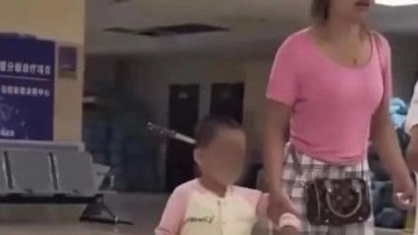 Una madre clava un cuchillo accidentalmente en la cabeza a su hija de 3 años y la lleva al hospital caminando
