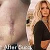 Khloe Kardashian shares frightening photos of 'crazy' plastic surgery stitches on her face
