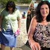 I regret my weight loss surgery: It was a miracle at first - but no one talks about the nightmare that can happen to your body just a few years later